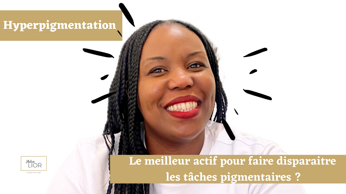 QUEL EST LE MEILLEUR ACTIF POUR FAIRE PARTIR MES TÂCHES PIGMENTAIRES ?